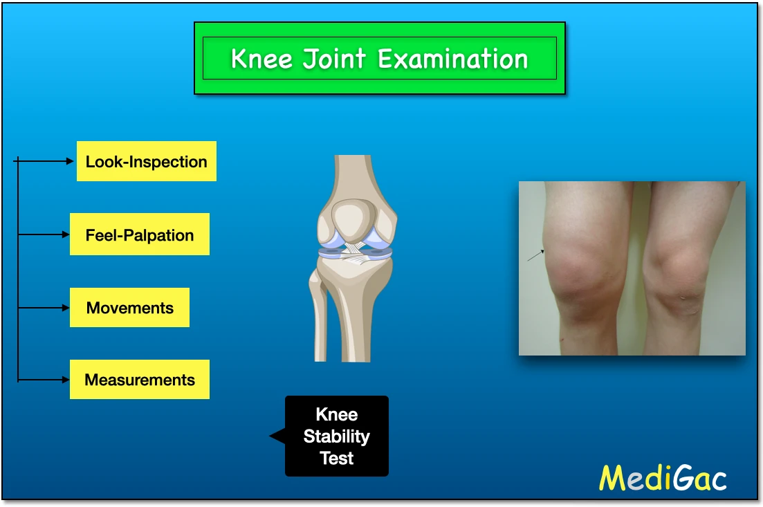 Knee joint examination